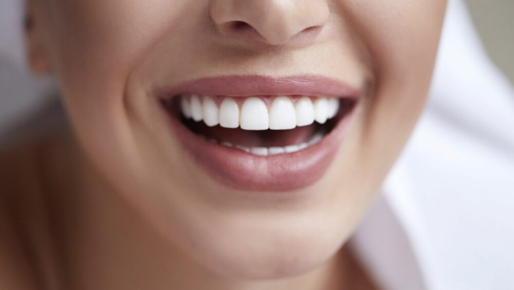  بهترین روش سفید کردن دندان چیست ؟