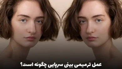 عمل ترمیمی بینی سرپایی چگونه است؟