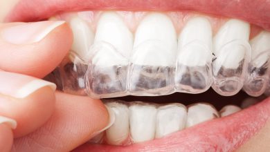 خرید کامپوزیت یا بلیچینگ و سفید کردن
