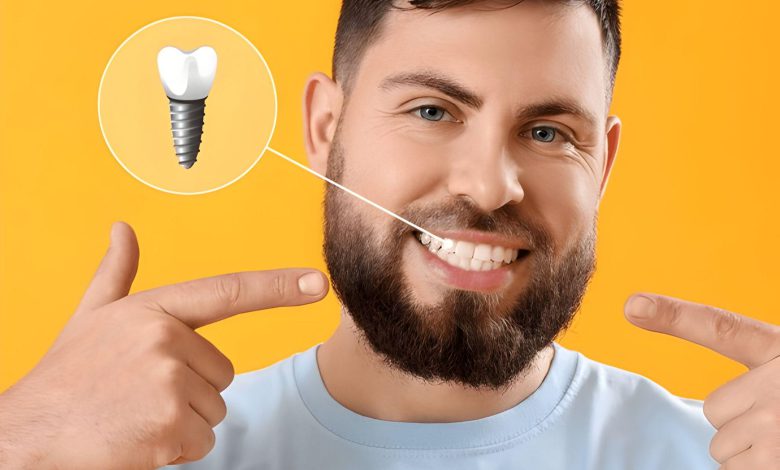 آیا ایمپلنت دندان خوب است؟
