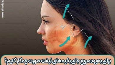 برای بهبود سریع جای بخیه های لیفت صورت چه کار کنیم؟